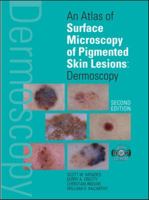 An Atlas of Surface Microscopy of Pigmented Skin Lesions: Dermoscopy, Second Edition 0074711024 Book Cover