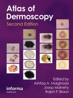 An Atlas of Dermoscopy 1842142259 Book Cover
