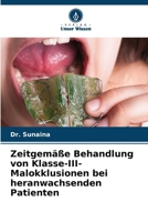 Zeitgemäße Behandlung von Klasse-III-Malokklusionen bei heranwachsenden Patienten (German Edition) 6208551676 Book Cover