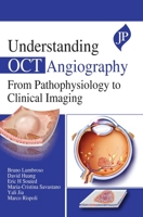 Understanding Oct Angiography from Pathophysiology to Clinical Imaging 1909836931 Book Cover