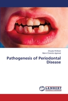 Pathogenesis of Periodontal Disease 6206144674 Book Cover