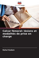 Calcar fémoral: lésions et modalités de prise en charge (French Edition) 6207687647 Book Cover