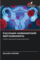 Carcinomi endometrioidi dell'endometrio: Profilo di espressione della proteina p53 6205292467 Book Cover