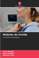 Nódulos da tiroide (Portuguese Edition) 6208042089 Book Cover