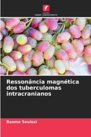 Ressonância magnética dos tuberculomas intracranianos 6206218414 Book Cover