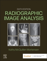 Radiographic Image Analysis 1437703364 Book Cover