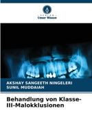 Behandlung von Klasse-III-Malokklusionen 6630216725 Book Cover
