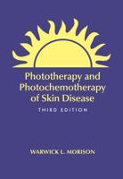 Phototherapy and Photochemotherapy for Skin Disease, Third Edition (Basic and Clinical Dermatology) 1574448803 Book Cover