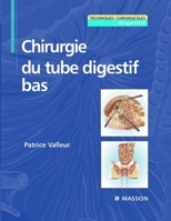 Chirurgie du tube digestif bas (French Edition) 2294017242 Book Cover