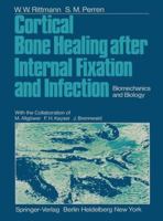 Cortical Bone Healing After Internal Fixation and Infection: Biomechanics and Biology 3642659799 Book Cover