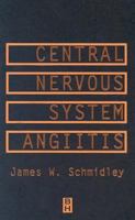 Central Nervous System Angiitis 075067153X Book Cover