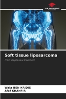 Soft tissue liposarcoma 6209596568 Book Cover