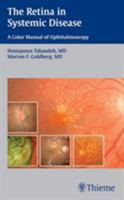 The Retina in Systemic Disease: A Color Manual of Ophthalmoscopy 1604060557 Book Cover