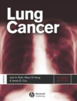 Lung Cancer 0865425736 Book Cover