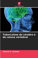 Tuberculose do cérebro e da coluna vertebral (Portuguese Edition) 6208380677 Book Cover