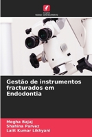 Gestão de instrumentos fracturados em Endodontia (Portuguese Edition) 6630091574 Book Cover