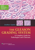 The Gleason Grading System: A Complete Guide for Pathologist and Clinicians 1451172826 Book Cover