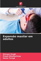 Expansão maxilar em adultos (Portuguese Edition) 6206937283 Book Cover