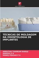 Técnicas de Moldagem Na Odontologia de Implantes (Portuguese Edition) 6630593707 Book Cover