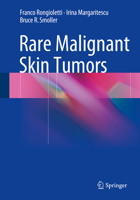 Rare Malignant Skin Tumors 1493920227 Book Cover