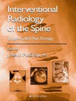 Interventional Radiology of the Spine: Image-Guided Pain Therapy 1588291987 Book Cover