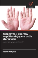 Luszczyca i choroby wspólistniejace u osób starszych (Polish Edition) 6630225325 Book Cover