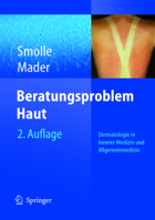 Beratungsproblem Haut: Dermatologie in Innerer Medizin und Allgemeinmedizin 3540211853 Book Cover