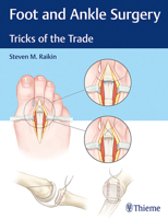 Foot and Ankle Surgery: Tricks of the Trade 1626234914 Book Cover