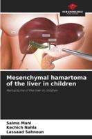 Mesenchymal hamartoma of the liver in children: Hamartoma of the liver in children 6208741335 Book Cover