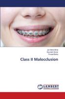 Class II Malocclusion 6202797665 Book Cover