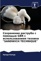 ?????????? ???????? ? ??????? GBR ? ?????????????? ??????? "SANDWICH TECHNIQUE" (Russian Edition) 6207589092 Book Cover
