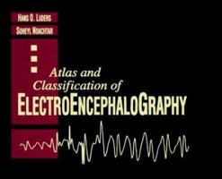 Atlas and Classification of Electroencephalography 0721665543 Book Cover