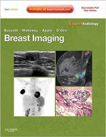 Breast Imaging: Expert Radiology Series Expert Consult- Online and Print 1416051996 Book Cover