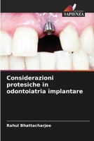 Considerazioni protesiche in odontoiatria implantare (Italian Edition) 6207989899 Book Cover