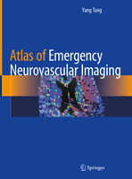 Atlas of Emergency Neurovascular Imaging 3030436535 Book Cover