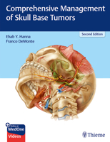 Comprehensive Management of Skull Base Tumors 1626235325 Book Cover