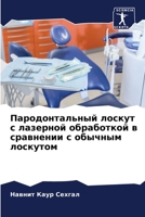 Пародонтальный лоскут с лазерной обработкой в сравнении с обычным лоскутом 6206080137 Book Cover