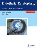 Endothelial Keratoplasty: Mastering DSEK, DMEK, and PDEK 1626234515 Book Cover