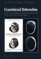 Craniofacial Deformities: Atlas of Three-Dimensional Reconstruction from Computed Tomography 1461279267 Book Cover