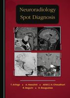 Neuroradiology Spot Diagnosis 1036449335 Book Cover