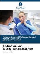 Reduktion von Wurzelkanalbakterien: Ein neuer Ansatz 6205837285 Book Cover