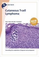 Fast Facts: Cutaneous T-Cell Lymphoma 1912776308 Book Cover