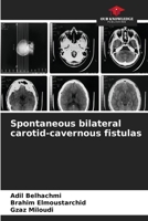 Spontaneous bilateral carotid-cavernous fistulas 6630323874 Book Cover
