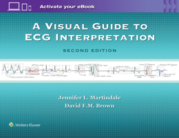 Rapid Interpretation of ECGs in Emergency Medicine: A Visual Guide 1451128371 Book Cover