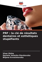 PRF : la clé de résultats dentaires et esthétiques stupéfiants 6206067696 Book Cover