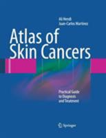 Atlas of Skin Cancers: Practical Guide to Diagnosis and Treatment 3662501651 Book Cover