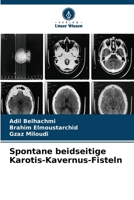 Spontane beidseitige Karotis-Kavernus-Fisteln (German Edition) 6630321316 Book Cover