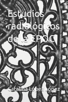 Estudios radiológicos de la EPOC B0FYCXNXHS Book Cover