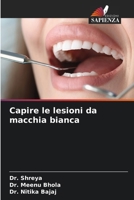 Capire le lesioni da macchia bianca (Italian Edition) 6209013007 Book Cover