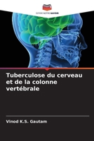 Tuberculose du cerveau et de la colonne vertébrale (French Edition) 6208380650 Book Cover